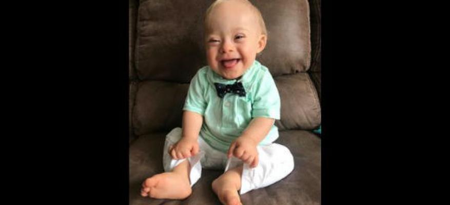 Ο Λούκας έγινε το πρώτο μωρό με σύνδρομο Down στην ιστορία της Gerber
